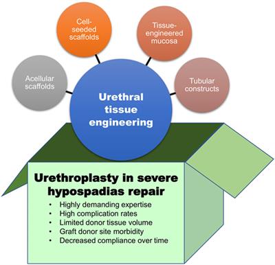 Current Status of Tissue Engineering in the Management of Severe Hypospadias